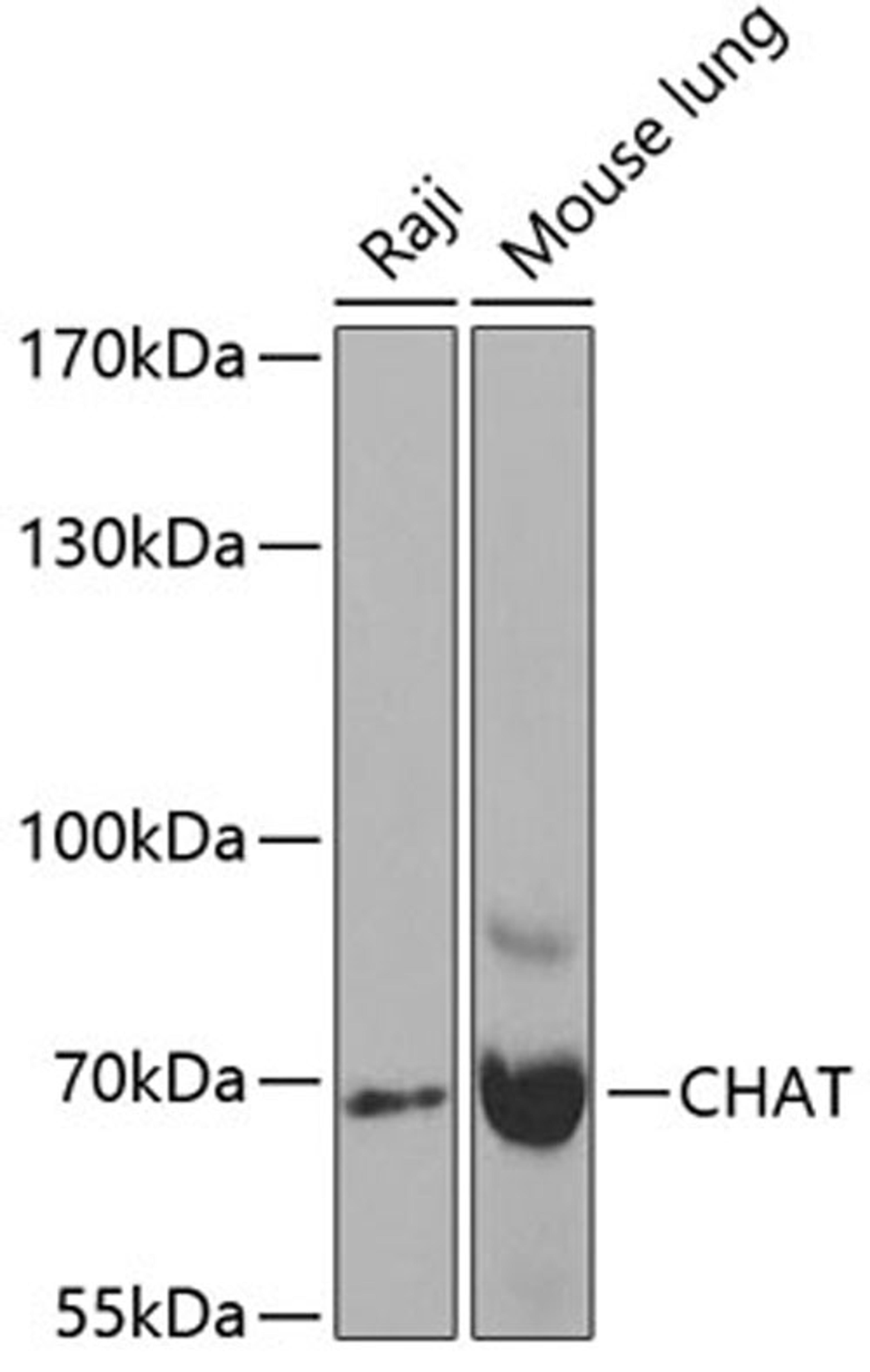 Western blot - CHAT antibody (A2495)