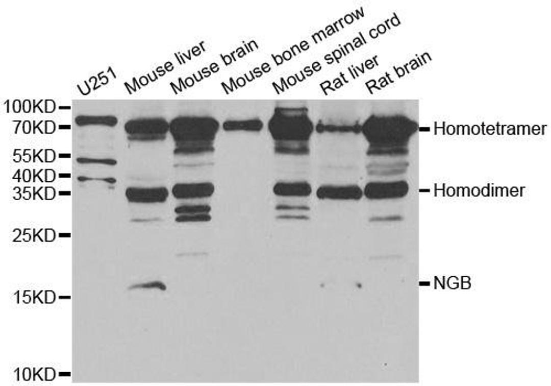 Western blot analysis of extracts of various cell lines using NGB antibody