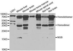 Western blot analysis of extracts of various cell lines using NGB antibody