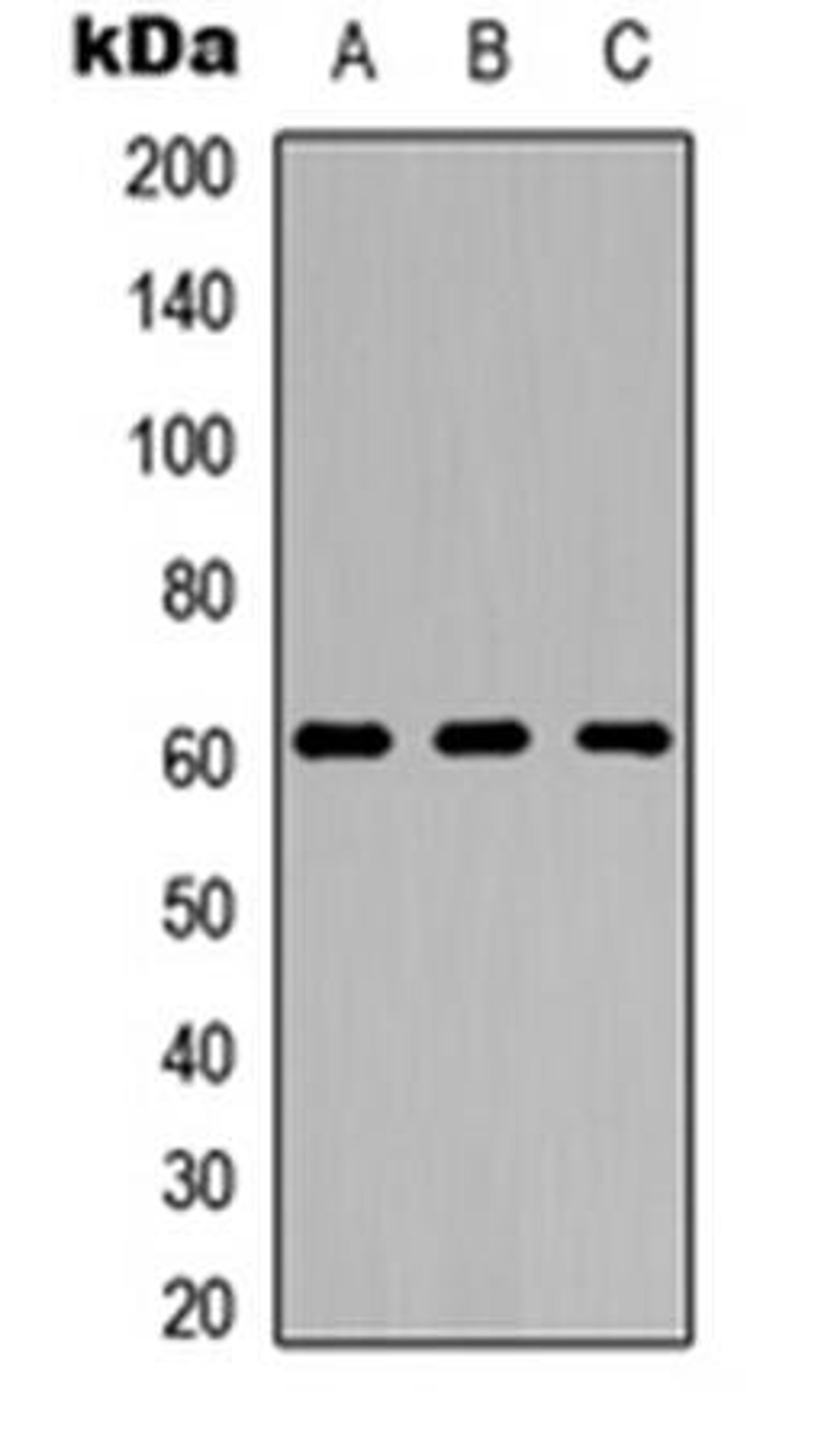 Western blot analysis of HeLa (Lane1), Raw264.7 (Lane2), PC12 (Lane3) whole cell using GPR123 antibody