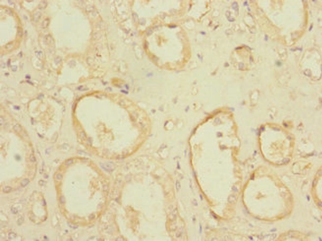 Immunohistochemistry of paraffin-embedded human kidney tissue using CSB-PA018298LA01HU at dilution of 1:100