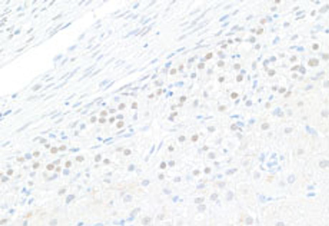 Detection of human GATA4 by immunohistochemistry.