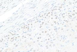 Detection of human GATA4 by immunohistochemistry.