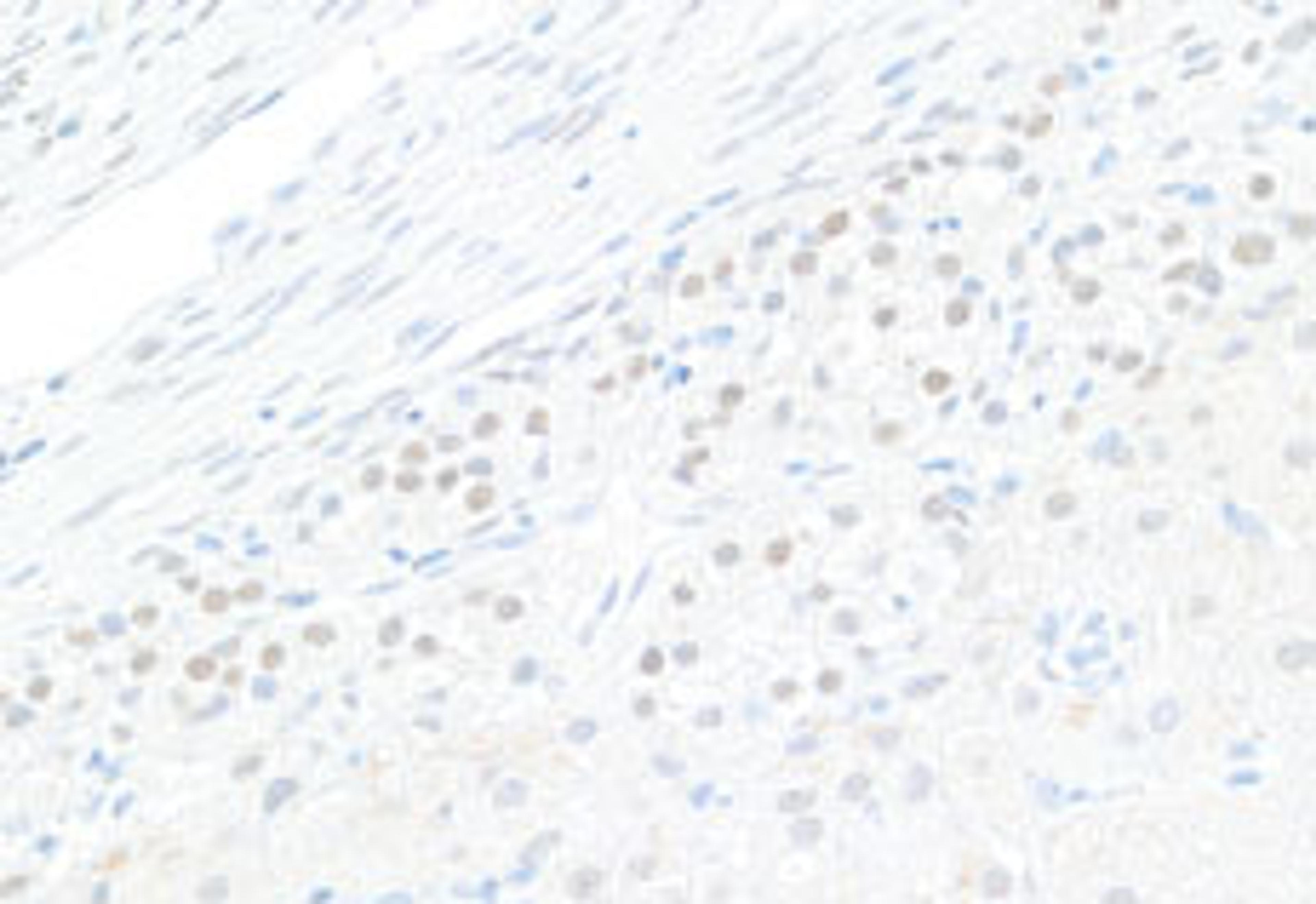 Detection of human GATA4 by immunohistochemistry.