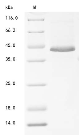 (Tris-Glycine gel) Discontinuous SDS-PAGE (reduced) with 5% enrichment gel and 15% separation gel.