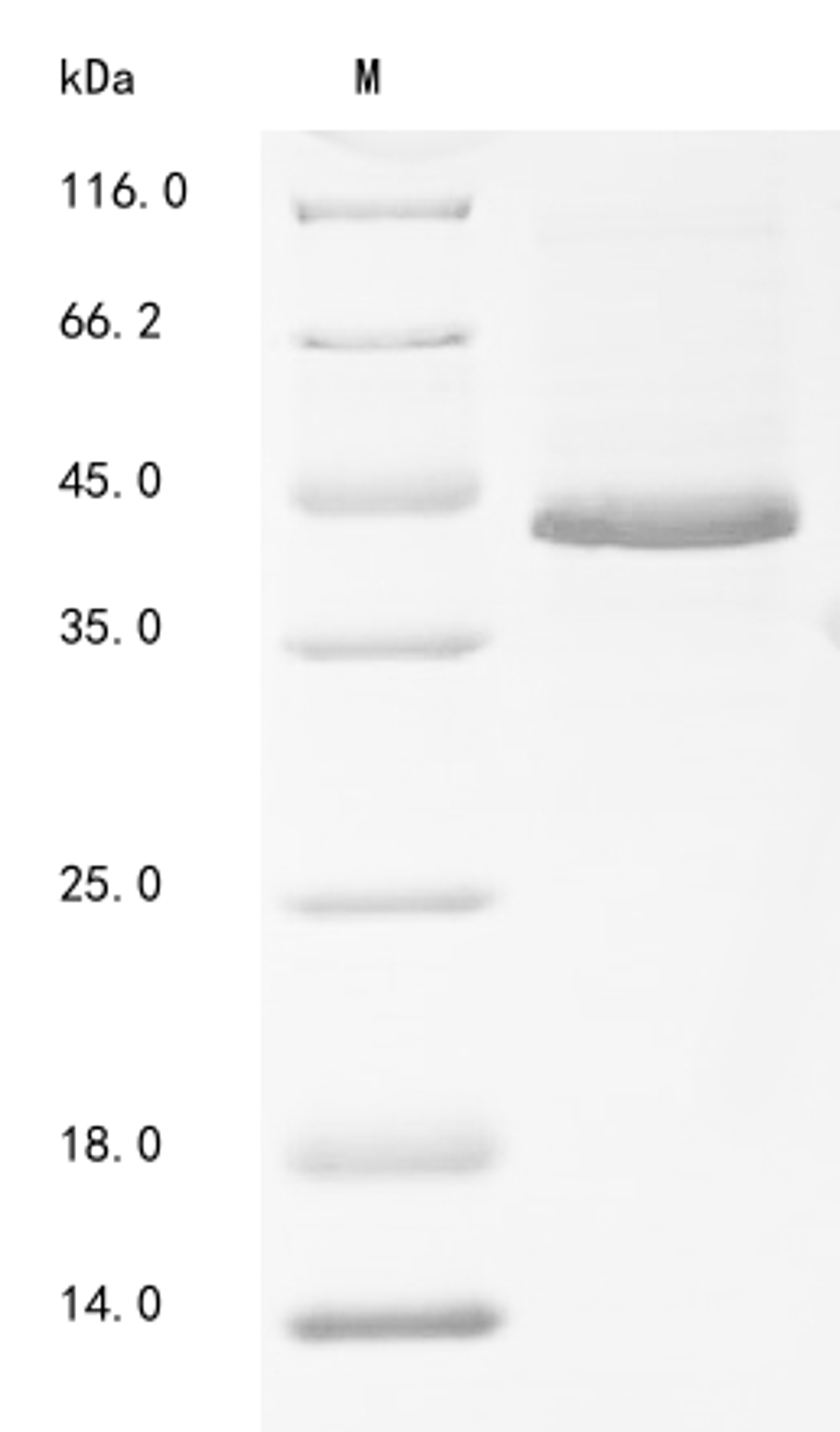 (Tris-Glycine gel) Discontinuous SDS-PAGE (reduced) with 5% enrichment gel and 15% separation gel.