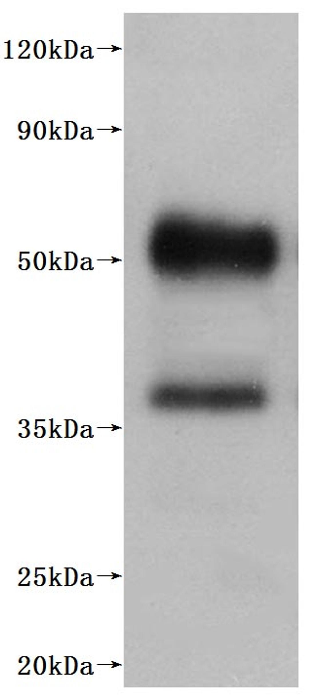CSB-MP003996HU is detected by Mouse anti-6*His monoclonal antibody.