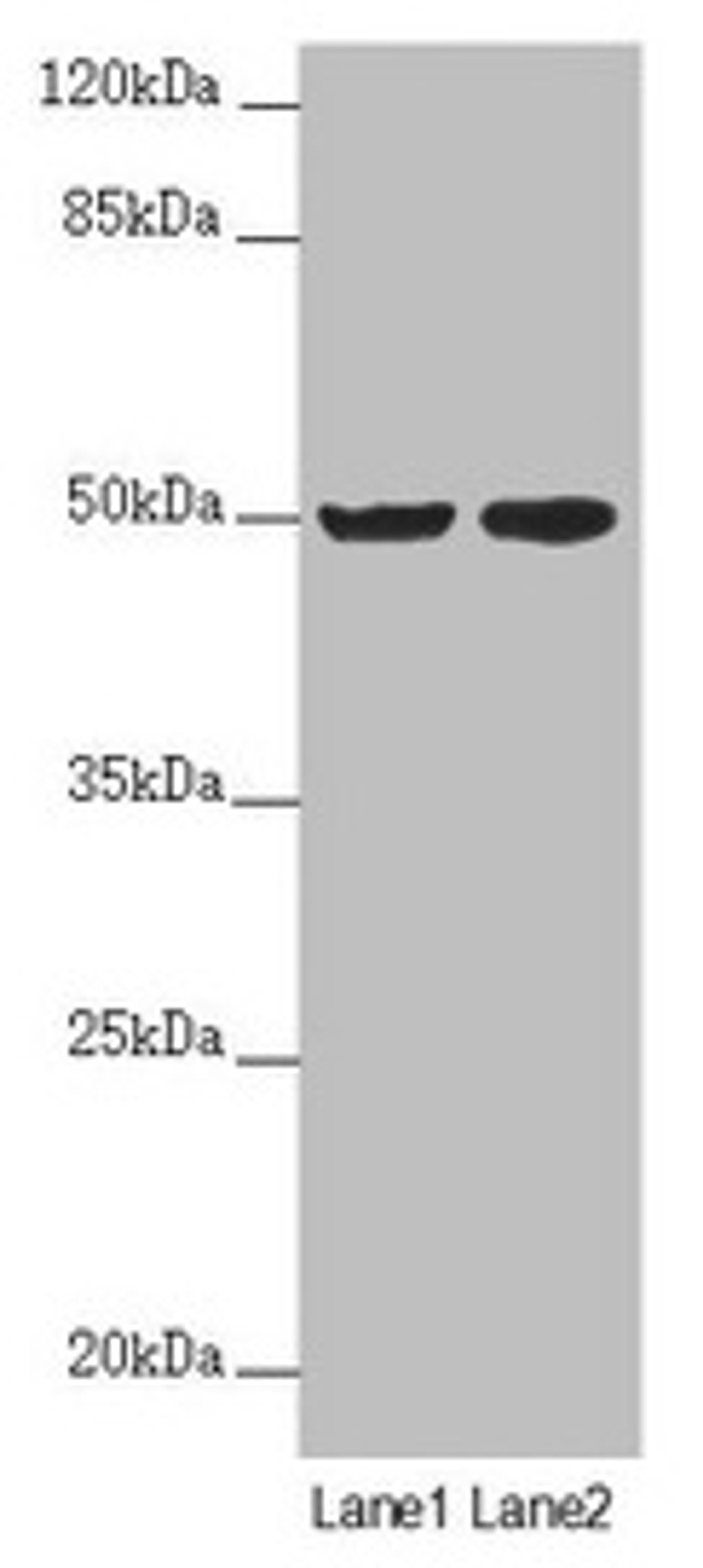 Western blot. All lanes: SLC39A7 antibody at 4.06µg/ml. Lane 1: MCF-7 whole cell lysate. Lane 2: HepG2 whole cell lysate. Secondary. Goat polyclonal to rabbit IgG at 1/10000 dilution. Predicted band size: 51 kDa. Observed band size: 51 kDa