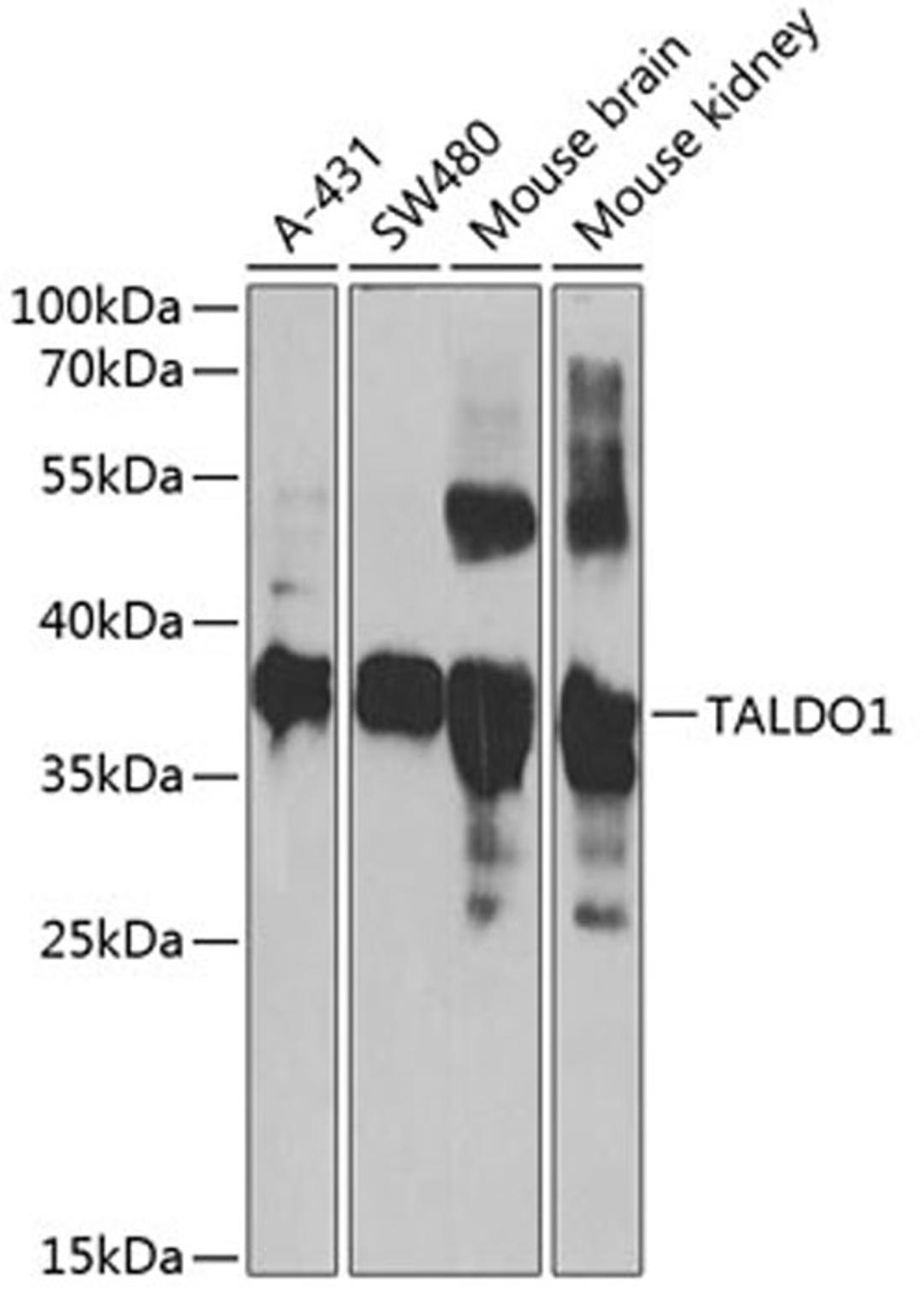 Western blot - TALDO1 antibody (A6762)