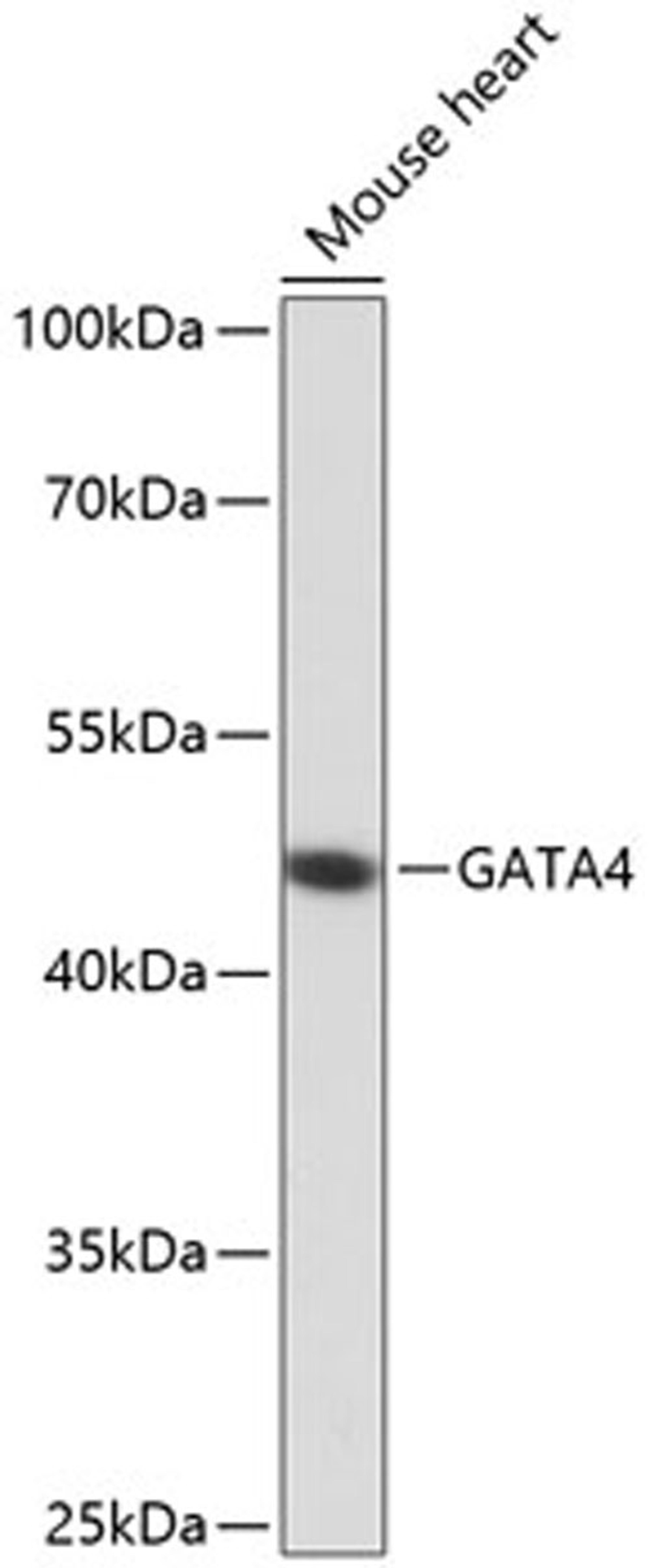 Western blot - GATA4 antibody (A13756)