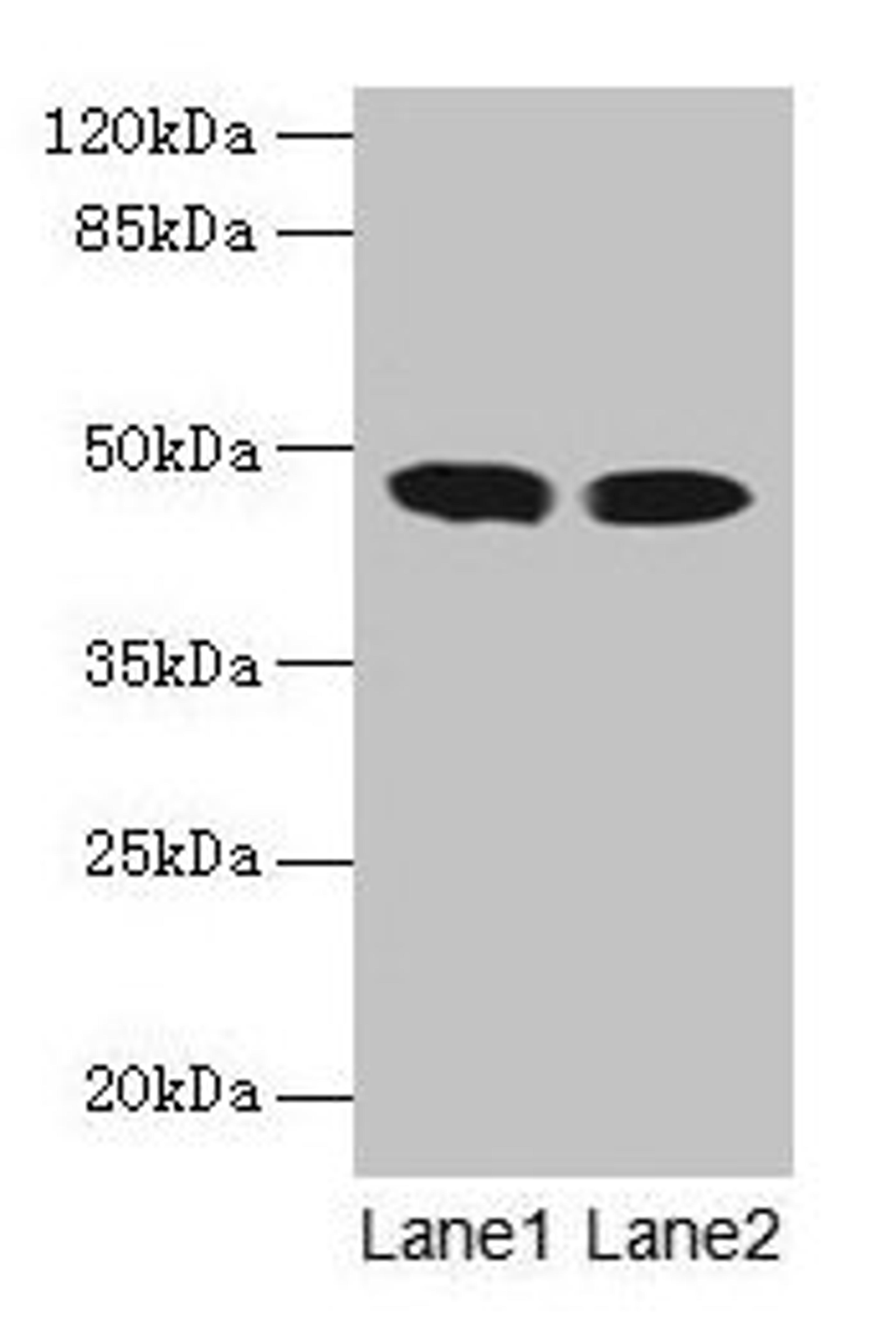Western blot. All lanes: ACADL antibody at 8µg/ml. Lane 1: Mouse kidney tissue. Lane 2: Mouse heart tissue. Secondary. Goat polyclonal to rabbit IgG at 1/10000 dilution. Predicted band size: 48 kDa. Observed band size: 48 kDa
