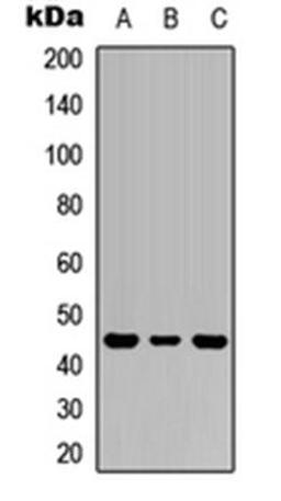 Western blot analysis of HEK293T (Lane1), Raw264.7 (Lane2), PC12 (Lane3) whole cell using IL-1R2 antibody