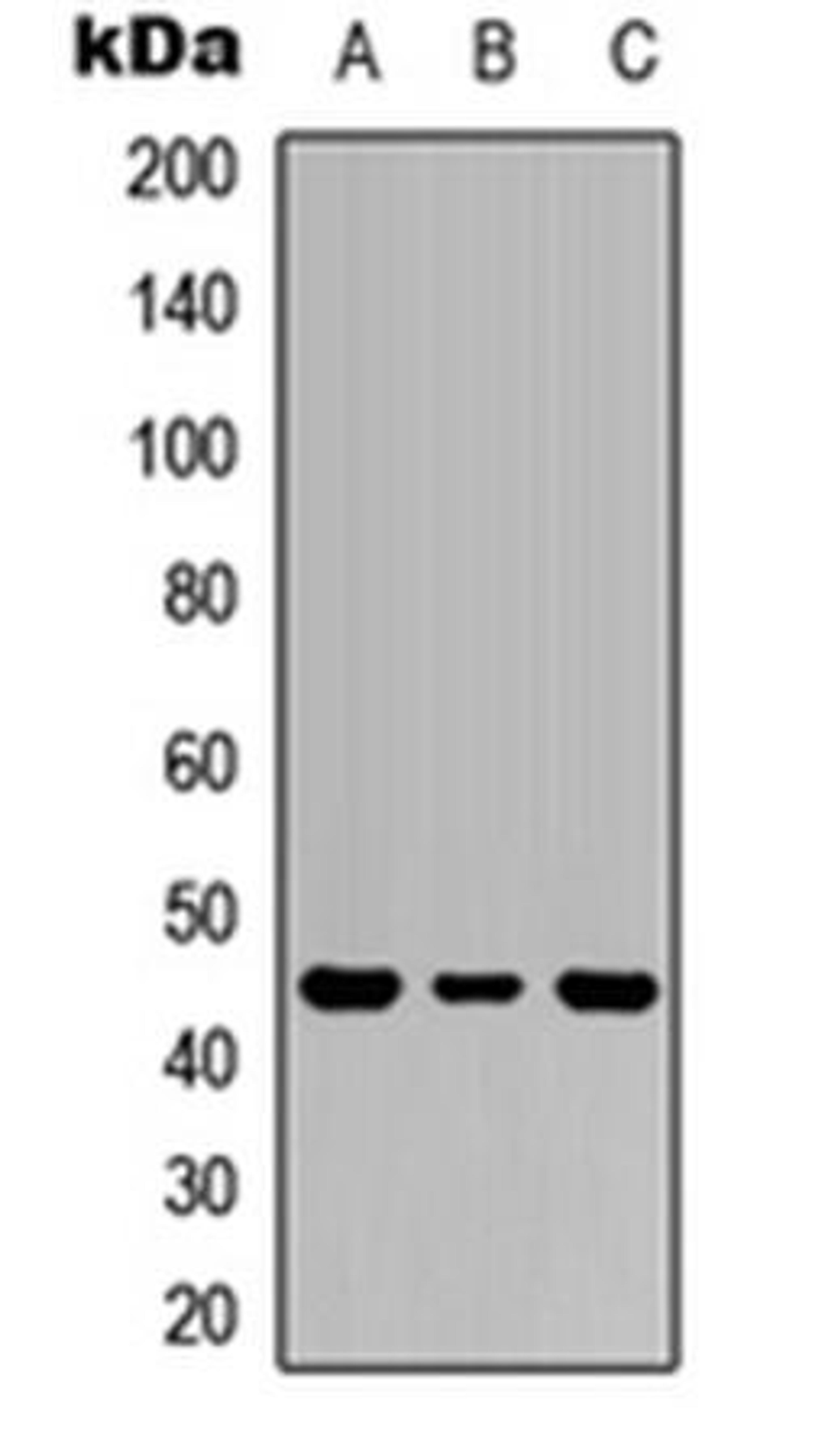 Western blot analysis of HEK293T (Lane1), Raw264.7 (Lane2), PC12 (Lane3) whole cell using IL-1R2 antibody