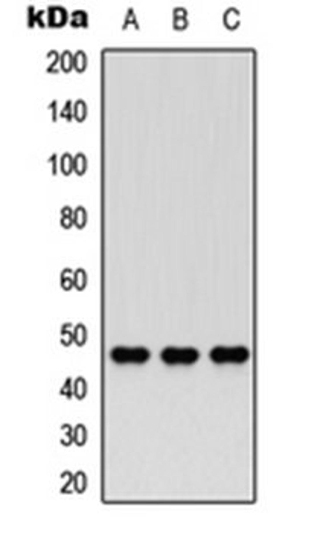 Western blot analysis of HEK293T (Lane 1), PC12 (Lane 2), HeLa (Lane 3) whole cell lysates using Nocturnin antibody