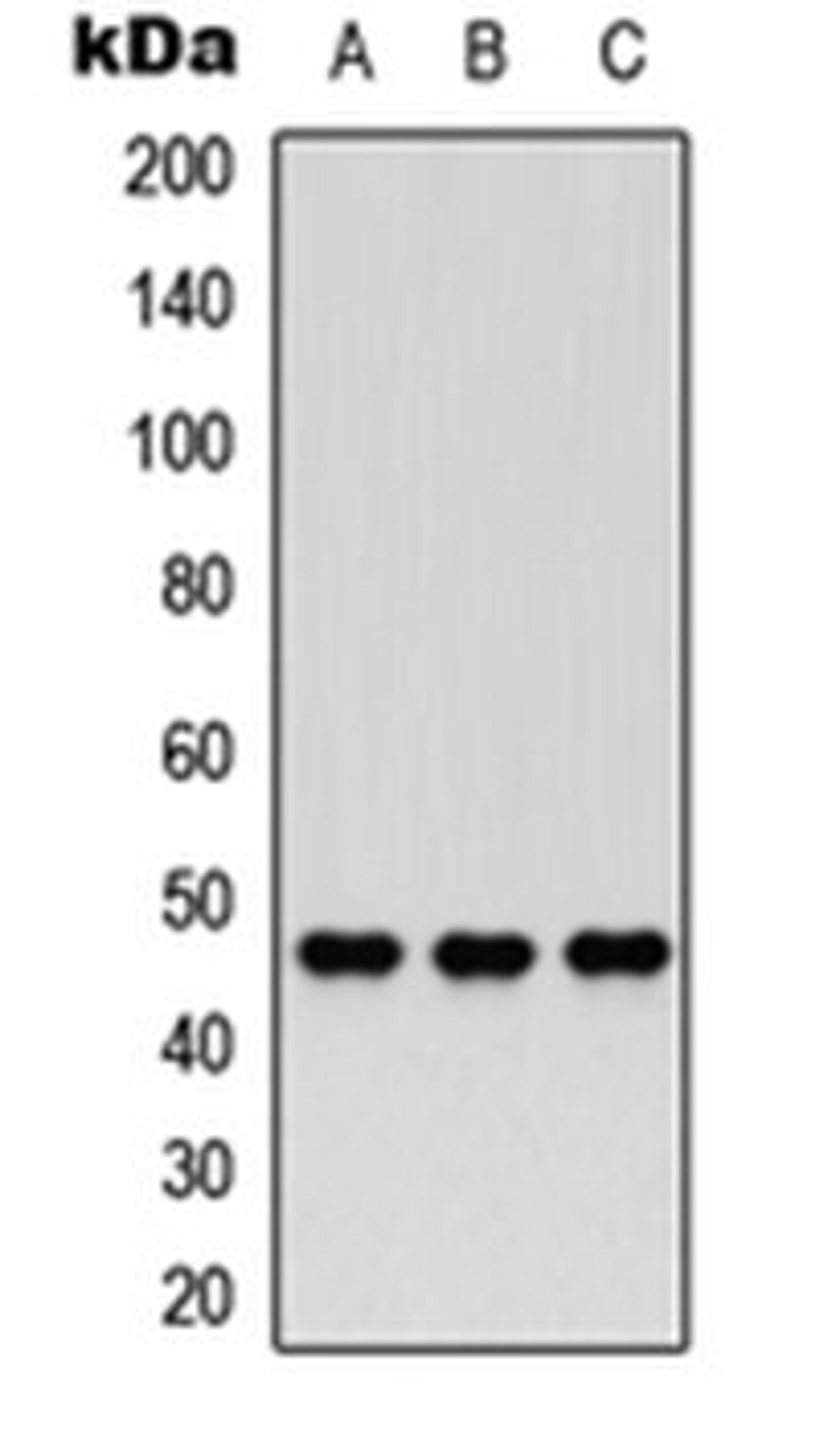 Western blot analysis of HEK293T (Lane 1), PC12 (Lane 2), HeLa (Lane 3) whole cell lysates using Nocturnin antibody