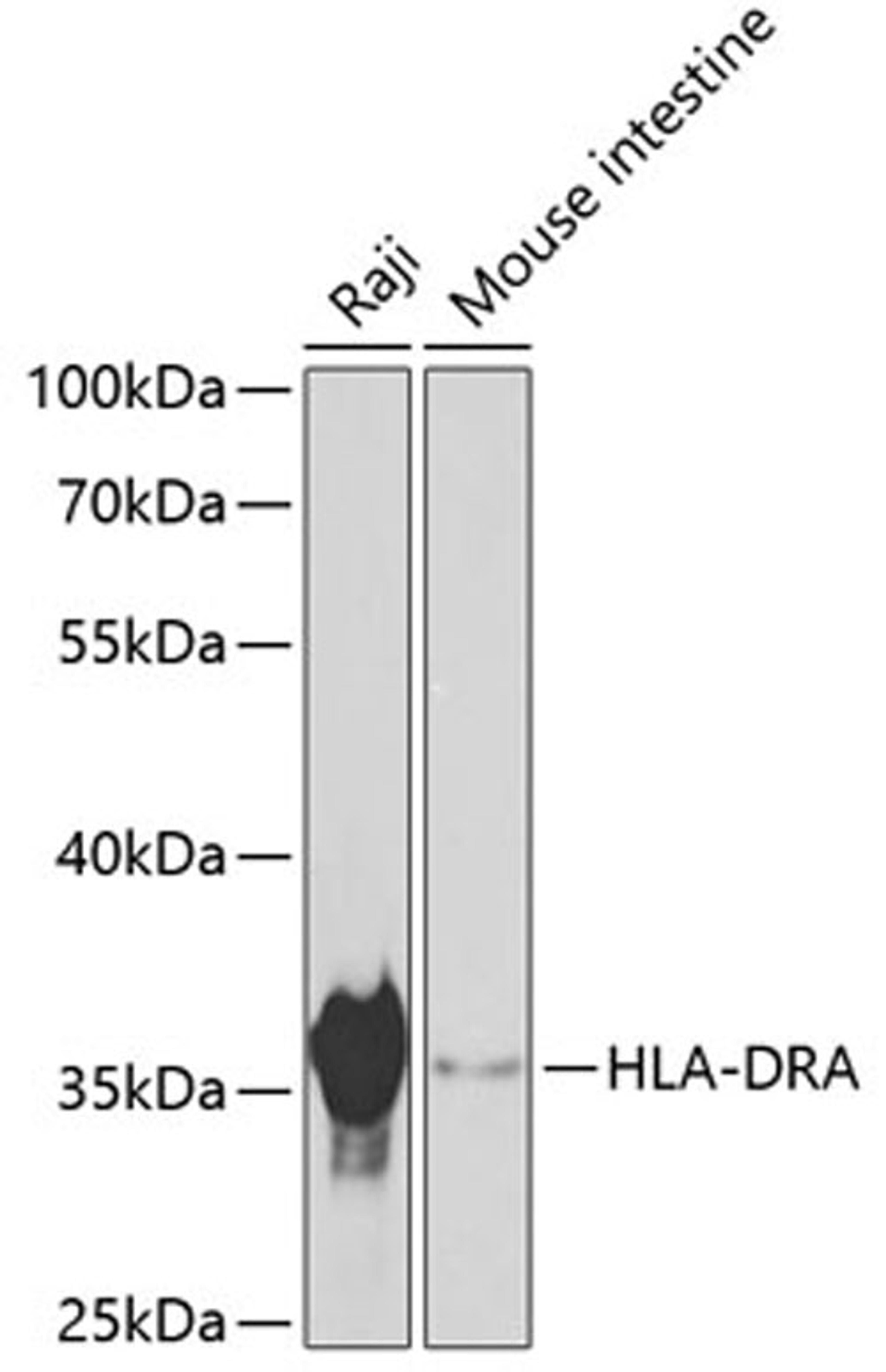 Western blot - HLA-DRA antibody (A11790)