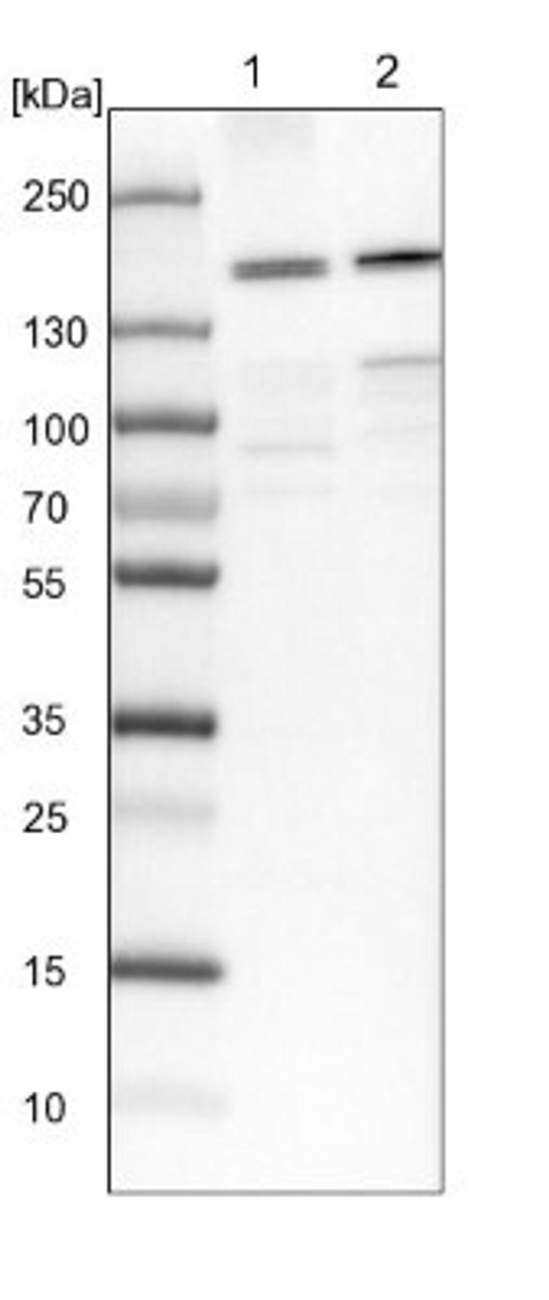 Western Blot: SBNO1 Antibody [NBP1-83837] - Lane 1: NIH-3T3 cell lysate (Mouse embryonic fibroblast cells)<br/>Lane 2: NBT-II cell lysate (Rat Wistar bladder tumour cells)