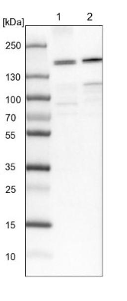 Western Blot: SBNO1 Antibody [NBP1-83837] - Lane 1: NIH-3T3 cell lysate (Mouse embryonic fibroblast cells)<br/>Lane 2: NBT-II cell lysate (Rat Wistar bladder tumour cells)