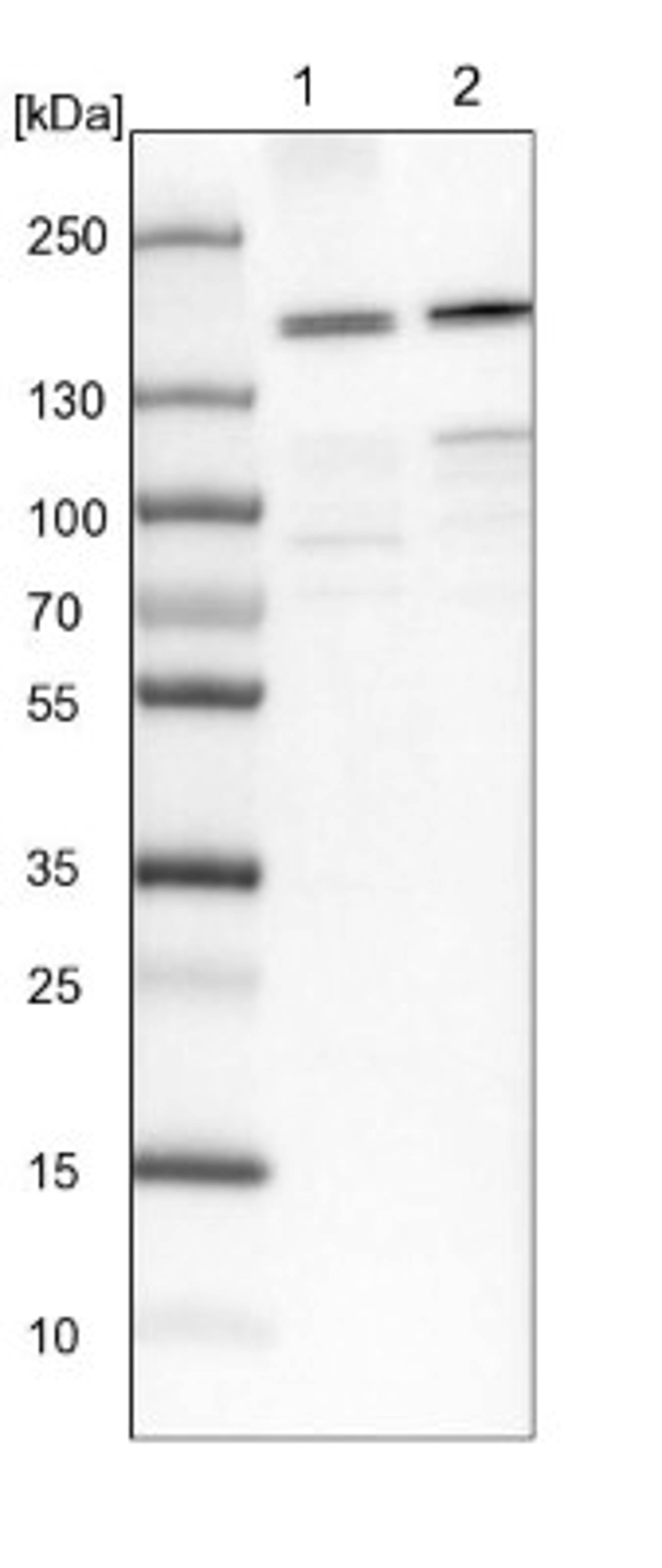 Western Blot: SBNO1 Antibody [NBP1-83837] - Lane 1: NIH-3T3 cell lysate (Mouse embryonic fibroblast cells)<br/>Lane 2: NBT-II cell lysate (Rat Wistar bladder tumour cells)