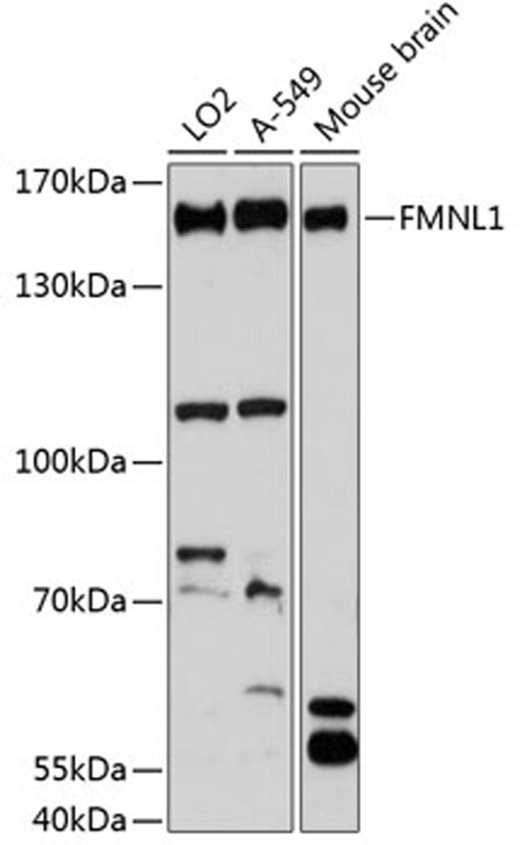 Western blot - FMNL1 antibody (A13010)