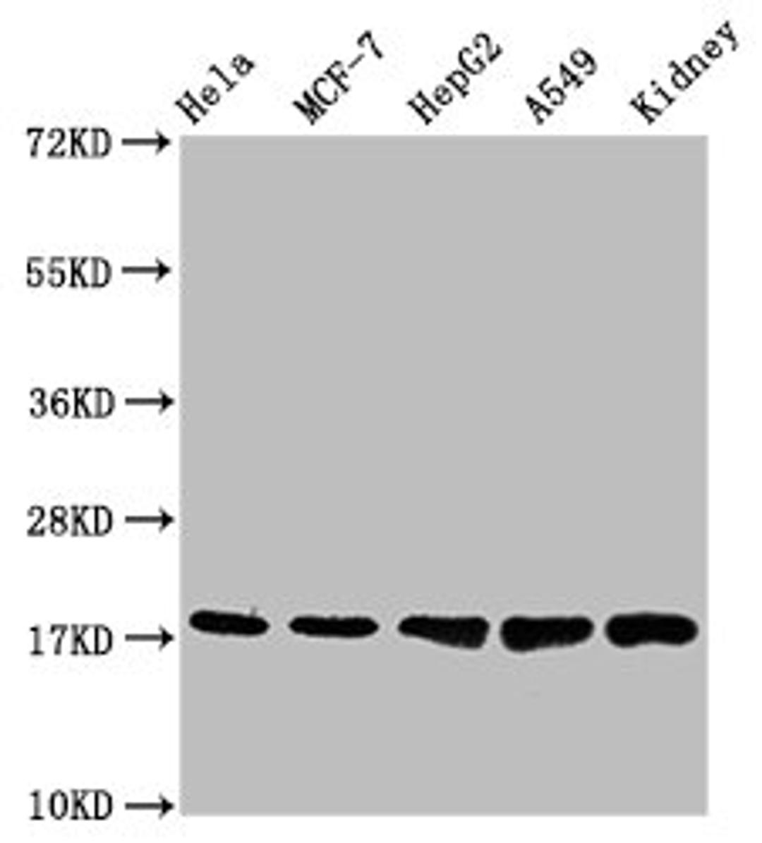 Western Blot. Positive WB detected in: Hela whole cell lysate, MCF-7 whole cell lysate, HepG2 whole cell lysate, A549 whole cell lysate, Mouse kidney tissue. All lanes: PBR antibody at 1.2μg/ml. Secondary. Goat polyclonal to rabbit IgG at 1/50000 dilution. Predicted band size: 19, 11 KDa. Observed band size: 19 KDa. 