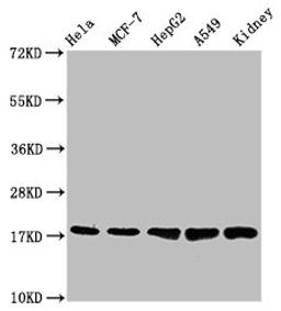 Western Blot. Positive WB detected in: Hela whole cell lysate, MCF-7 whole cell lysate, HepG2 whole cell lysate, A549 whole cell lysate, Mouse kidney tissue. All lanes: PBR antibody at 1.2μg/ml. Secondary. Goat polyclonal to rabbit IgG at 1/50000 dilution. Predicted band size: 19, 11 KDa. Observed band size: 19 KDa. 