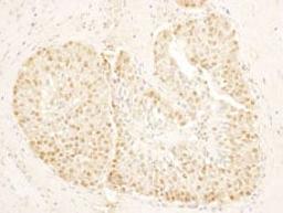 Detection of human SA1 by immunohistochemistry.