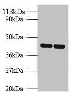 Western blot. All lanes: Vasopressin V1b receptor antibody at 2ug/ml. Lane 1: EC109 whole cell lysate. Lane 2: 293T whole cell lysate. Secondary. Goat polyclonal to rabbit IgG at 1/10000 dilution. Predicted band size: 47 kDa. Observed band size: 47 kDa. 