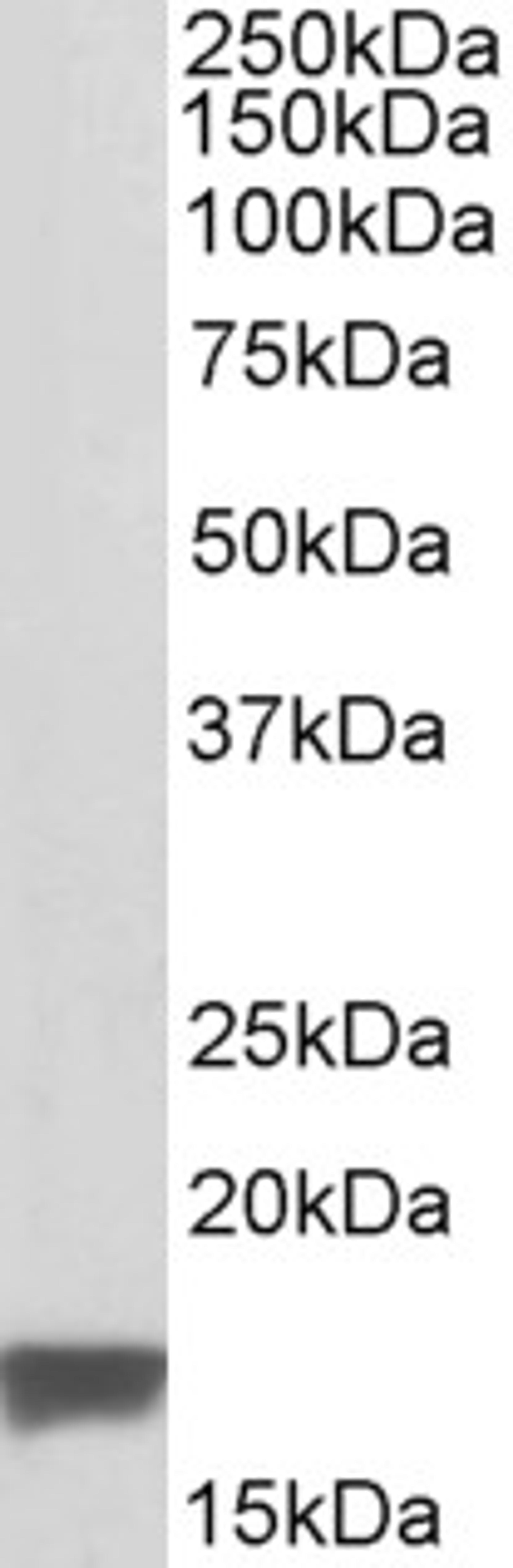 46-538 (0.1ug/ml) staining of Human Breast Cancer lysate (35ug protein in RIPA buffer). Primary incubation was 1 hour. Detected by chemiluminescence.