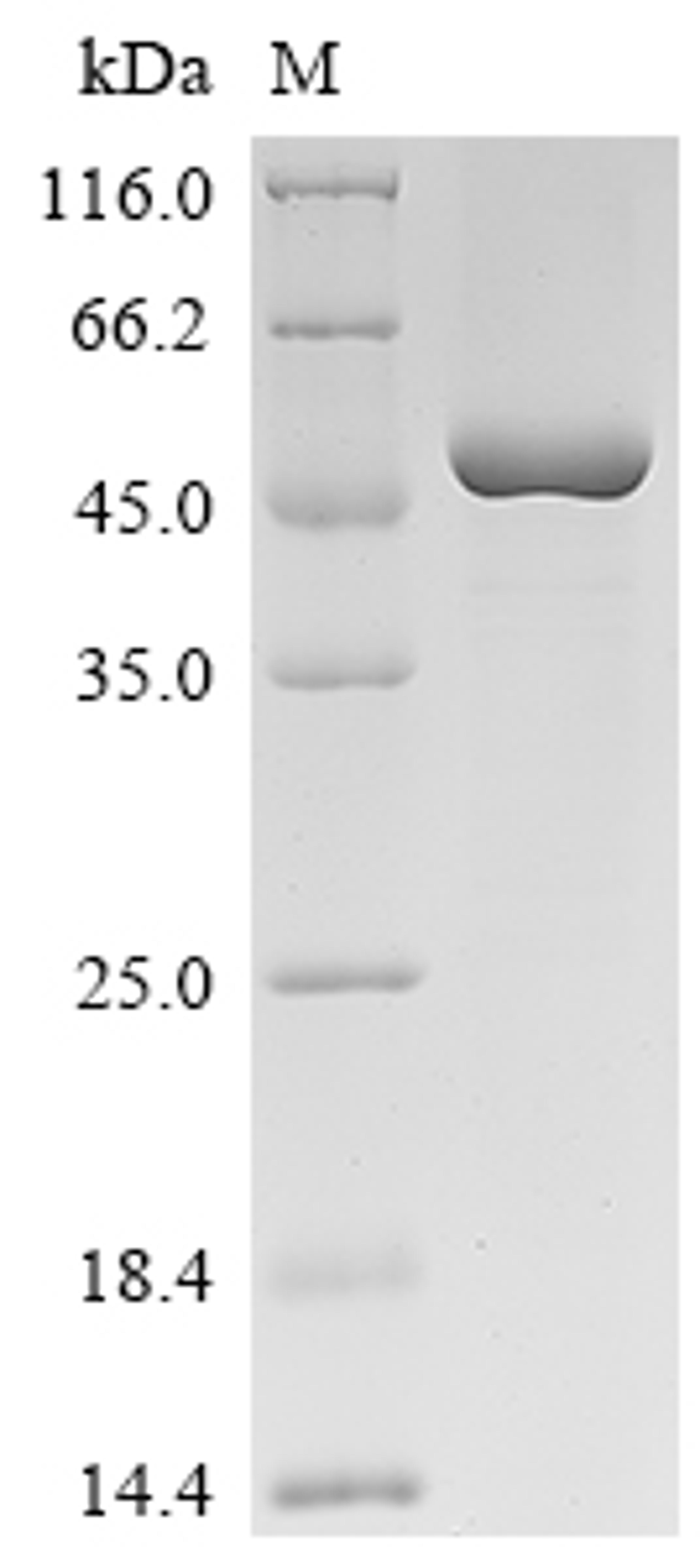 (Tris-Glycine gel) Discontinuous SDS-PAGE (reduced) with 5% enrichment gel and 15% separation gel.