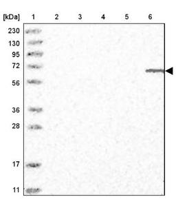 Western Blot: ELL2 Antibody [NBP1-89494] - Lane 1: Marker [kDa] 230, 130, 95, 72, 56, 36, 28, 17, 11<br/>Lane 2: Human cell line RT-4<br/>Lane 3: Human cell line U-251MG sp<br/>Lane 4: Human plasma (IgG/HSA depleted)<br/>Lane 5: Human liver tissue<br/>Lane 6: Human tonsil tissue