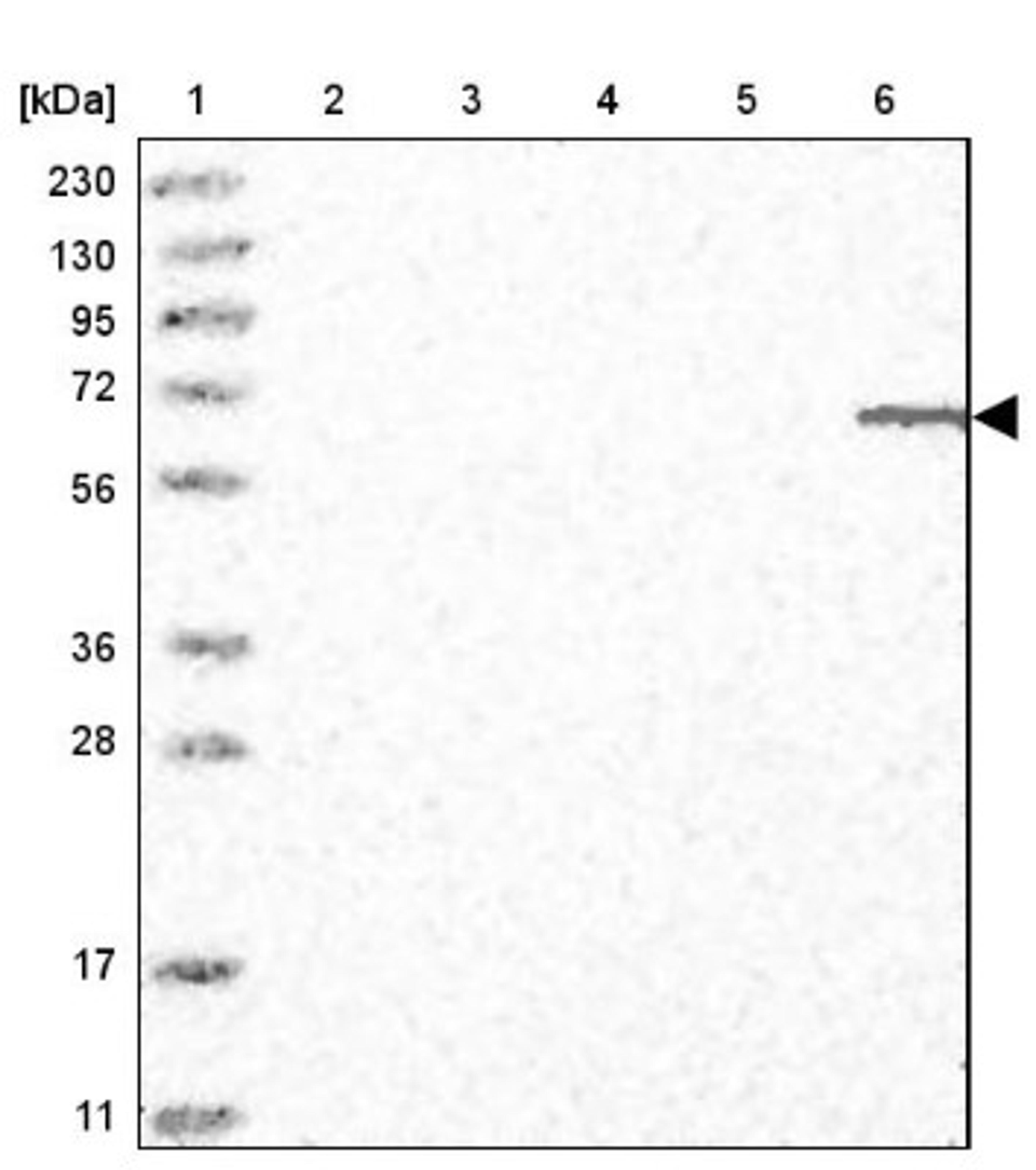 Western Blot: ELL2 Antibody [NBP1-89494] - Lane 1: Marker [kDa] 230, 130, 95, 72, 56, 36, 28, 17, 11<br/>Lane 2: Human cell line RT-4<br/>Lane 3: Human cell line U-251MG sp<br/>Lane 4: Human plasma (IgG/HSA depleted)<br/>Lane 5: Human liver tissue<br/>Lane 6: Human tonsil tissue