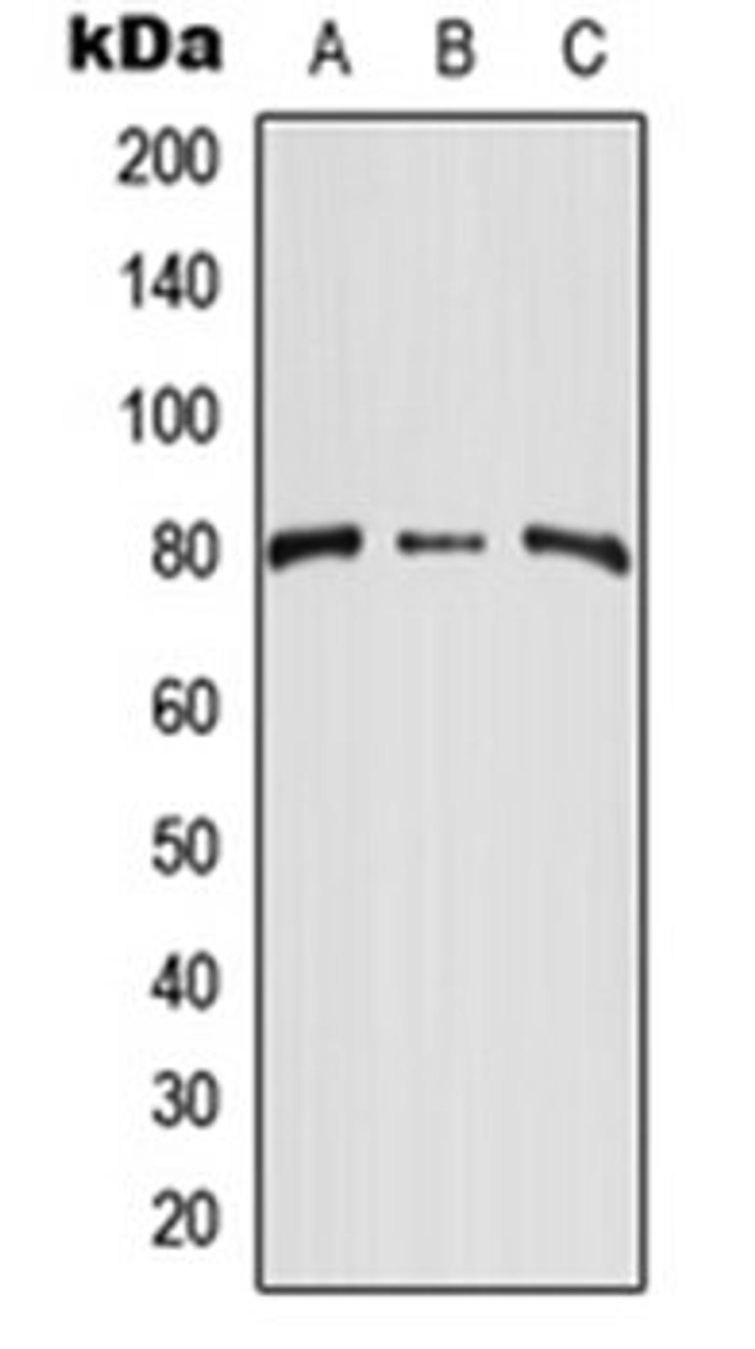 Western blot analysis of HEK293T (Lane 1), NIH3T3 (Lane 2), H9C2 (Lane 3) whole cell lysates using CD248 antibody