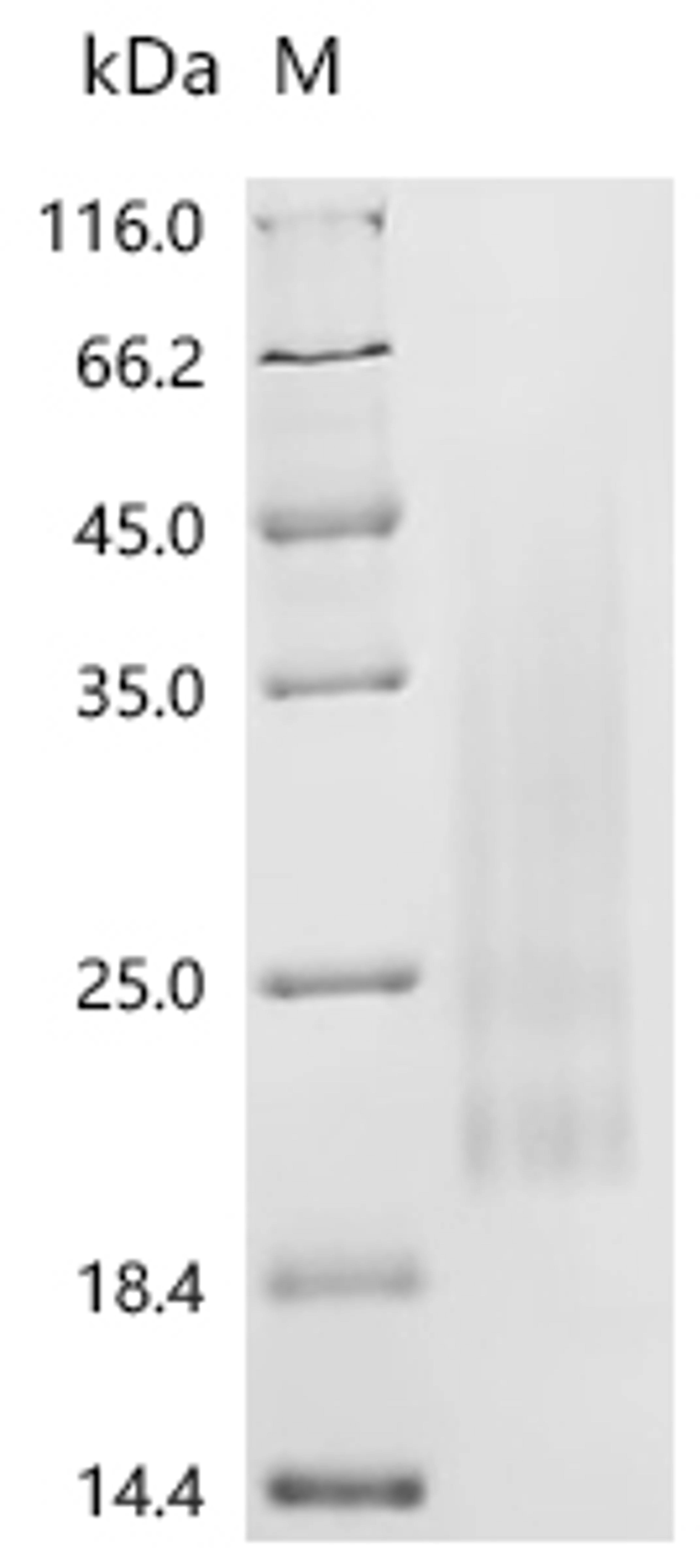 (Tris-Glycine gel) Discontinuous SDS-PAGE (reduced) with 5% enrichment gel and 15% separation gel.