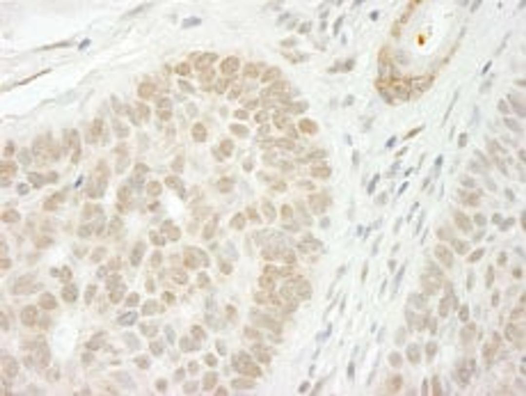 Detection of human CSTF2T/TauCSTF64 immunohistochemistry.