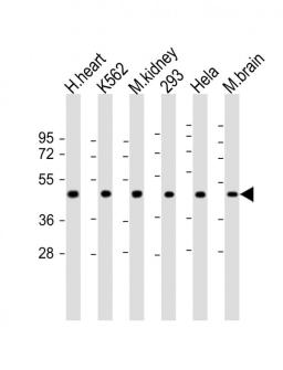 Western Blot at 1:2000 dilution Lane 1: human heart lysate Lane 2: K562 whole cell lysate Lane 3: mouse kidney lysate Lane 4: 293 whole cell lysate Lane 5: Hela whole cell lysate Lane 5: mouse brain lysate Lysates/proteins at 20 ug per lane.