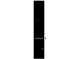 Western Blot: VDAC1 Antibody [NB100-695] - Lane 1: rat heart whole cell lysate. Lane 2: none. Load: 35 ug per lane. Primary antibody: VDAC/Porin antibody at 1:1,200 for overnight at 4C. Secondary antibody: IRDye800 (TM) rabbit secondary antibody at 1:10,000 for 45 min at RT. Block: 5% BLOTTO overnight at 4C. Predicted/Observed size: ~32 kDa corresponding to VDAC/Porin (arrowhead).