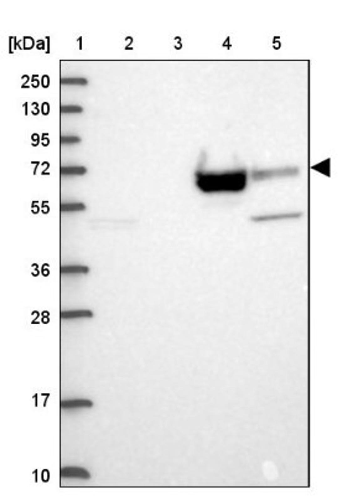 Western Blot: ZNF891 Antibody [NBP1-90894] - Lane 1: Marker [kDa] 250, 130, 95, 72, 55, 36, 28, 17, 10<br/>Lane 2: Human cell line RT-4<br/>Lane 3: Human cell line U-251MG sp<br/>Lane 4: Human plasma (IgG/HSA depleted)<br/>Lane 5: Human liver tissue