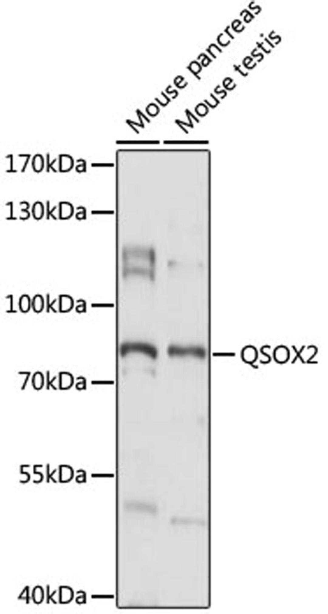 Western blot - QSOX2 antibody (A15214)