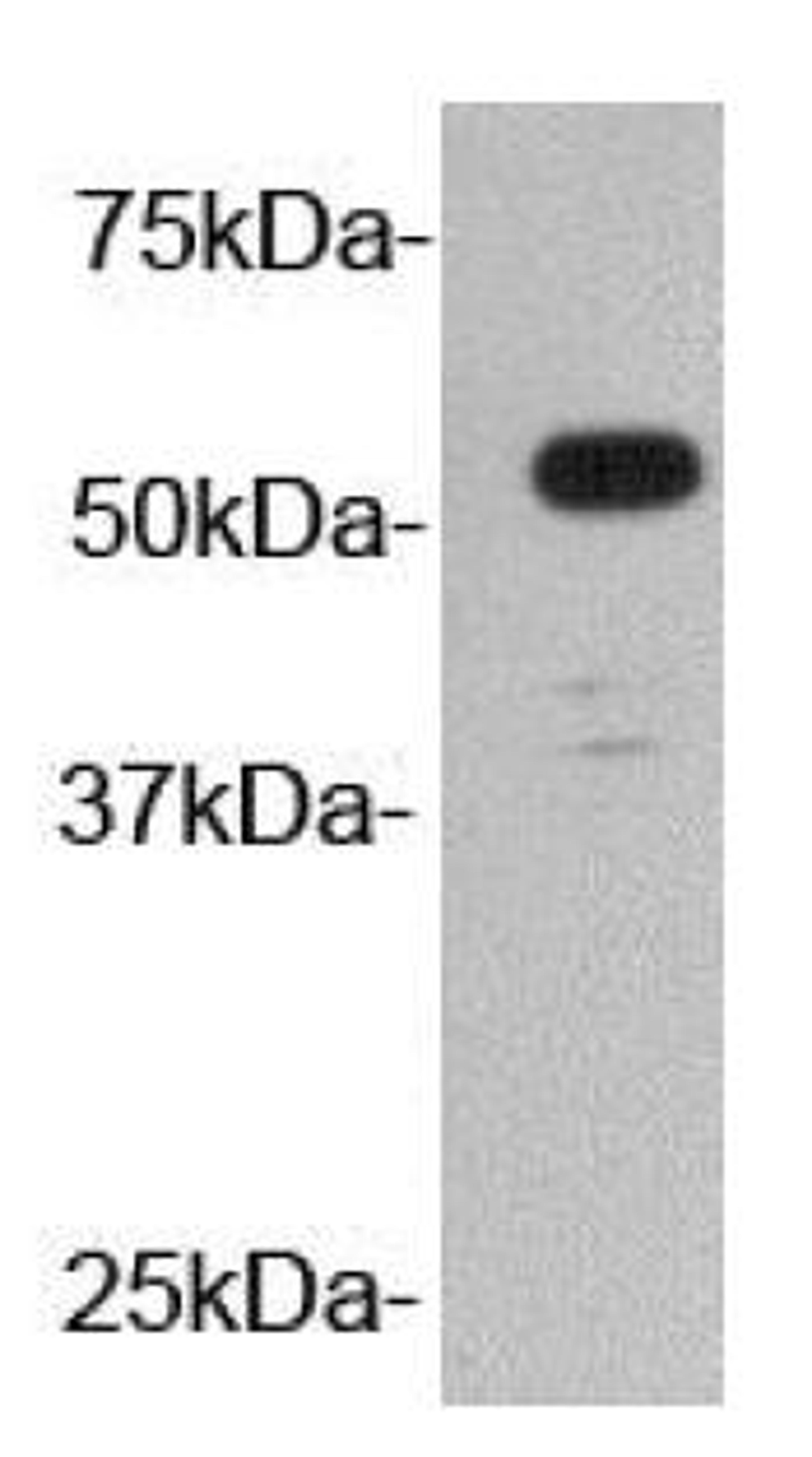 Western blot analysis of antigen band V5-tagged fusion proteins using V5-Tag antibody (HRP)