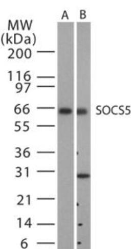 Western Blot: SOCS5 Antibody [NB100-56639] - Western blot analysis for SOCS5 using NB100-56639 at 1:500 dilution against 15 ug/lane of mouse spleen (lane A) and human spleen (lane B) lysates.