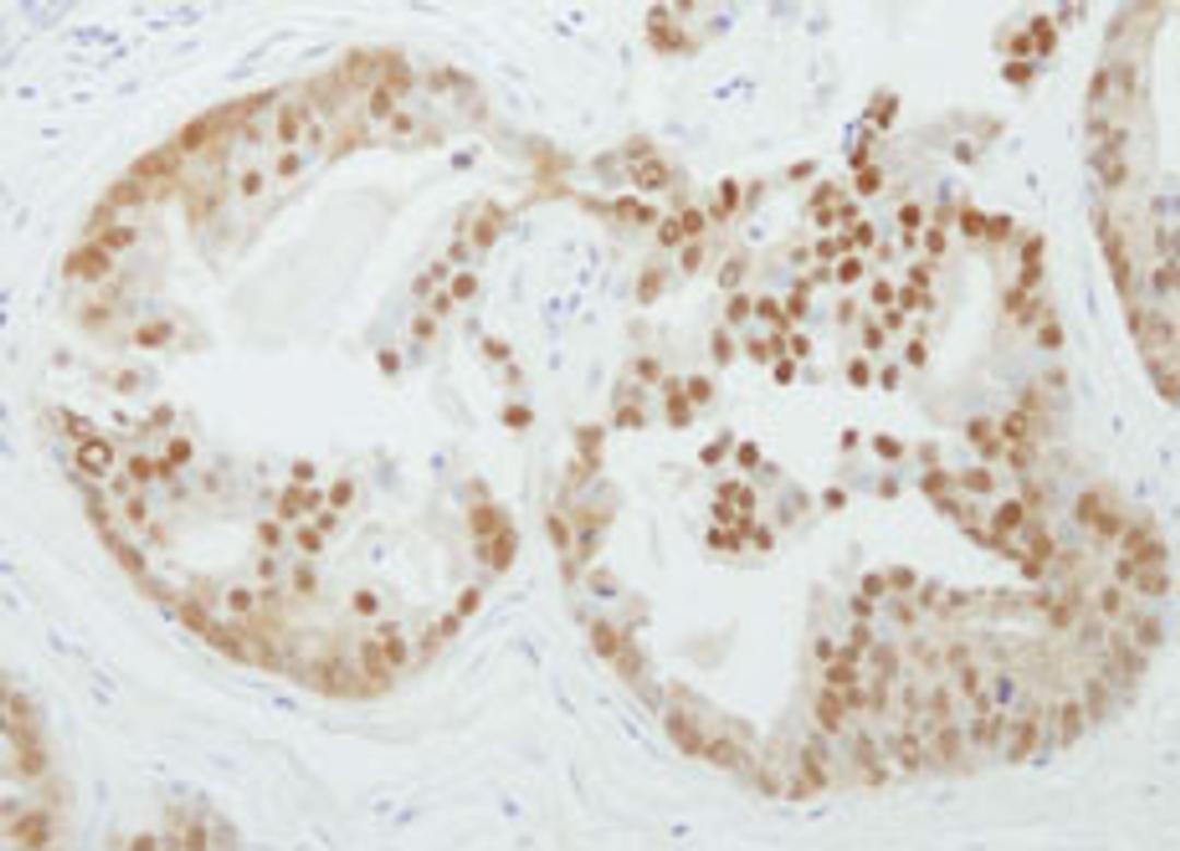 Detection of human PRMT5 by immunohistochemistry.