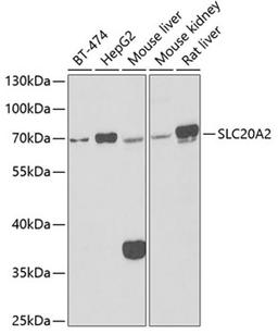 Western blot - SLC20A2 antibody (A6739)