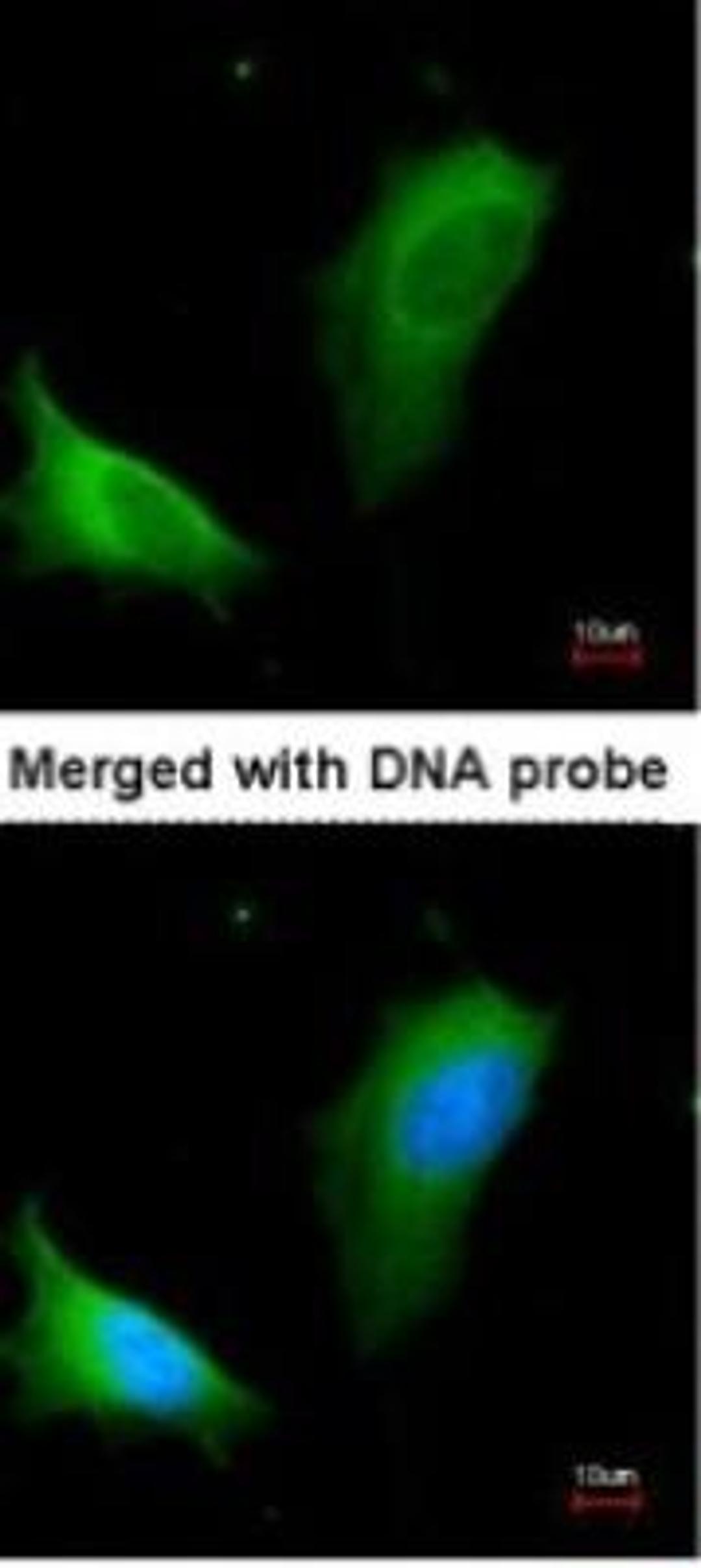 Immunocytochemistry/Immunofluorescence: Arginase 1/ARG1/liver Arginase Antibody [NBP1-32731] - Paraformaldehyde-fixed HeLa.