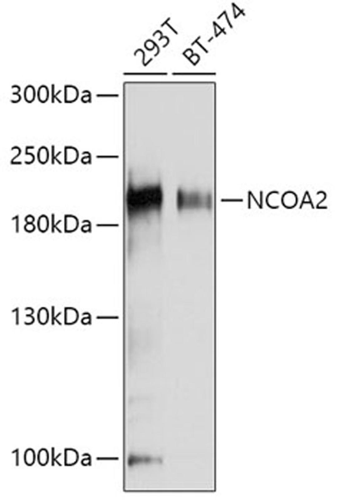 Western blot - NCOA2 antibody (A10280)