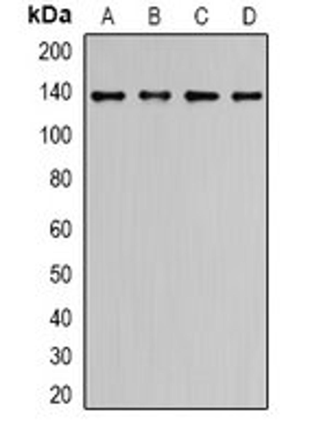 Western blot analysis of LO2 (Lane1), HCT116 (Lane2), COLO205 (Lane3), HepG2 (Lane4) whole cell lysates using ALPK1 antibody