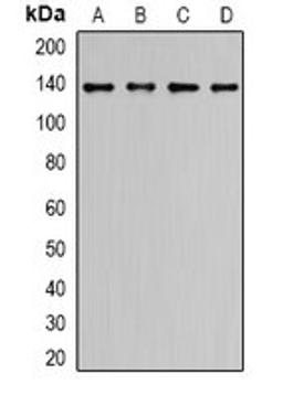 Western blot analysis of LO2 (Lane1), HCT116 (Lane2), COLO205 (Lane3), HepG2 (Lane4) whole cell lysates using ALPK1 antibody