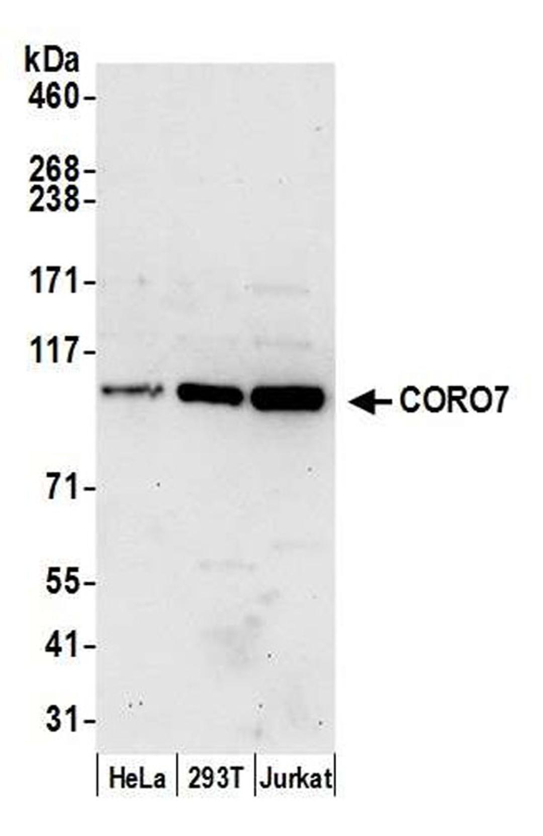 Detection of human CORO7 by WB.