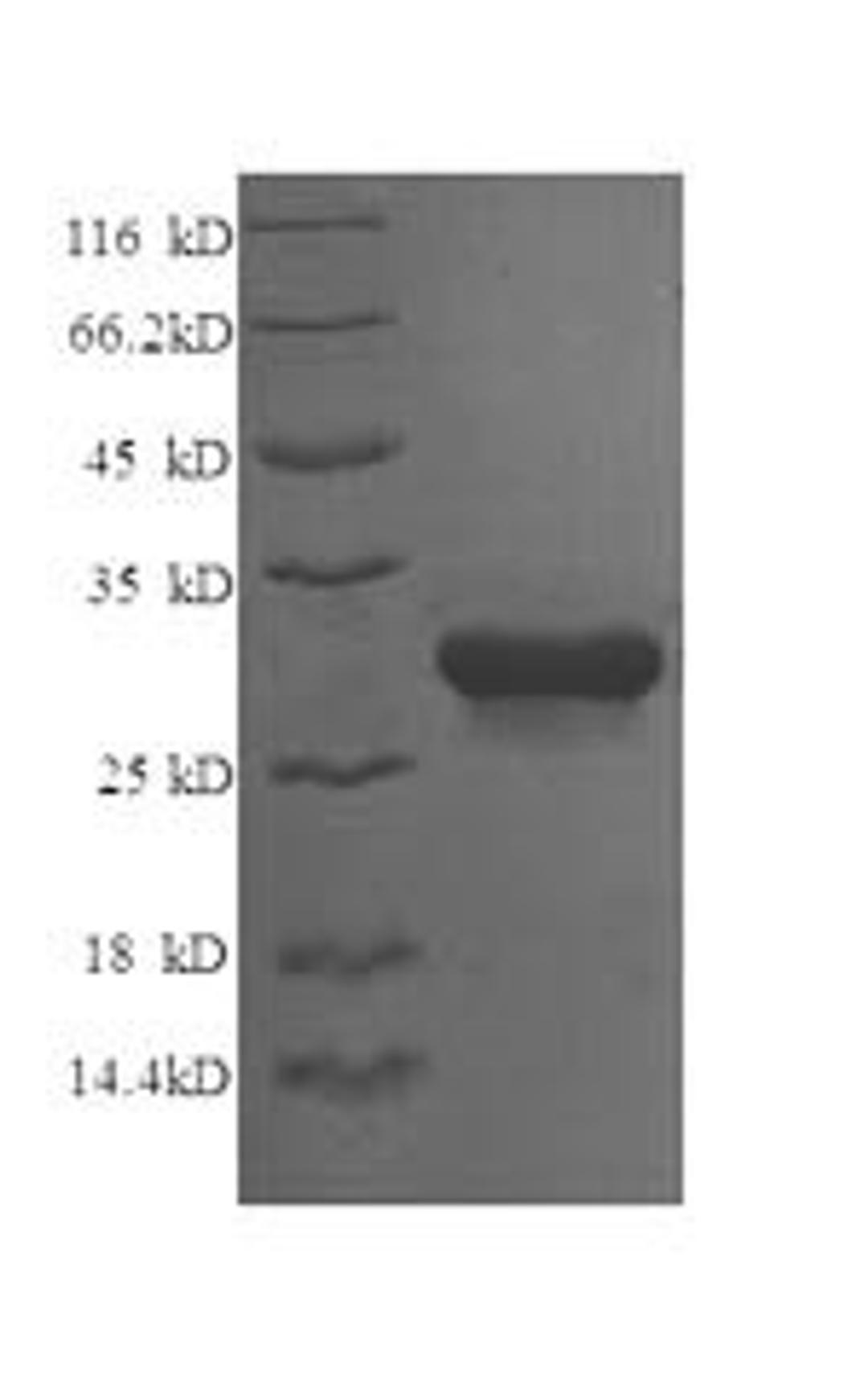(Tris-Glycine gel) Discontinuous SDS-PAGE (reduced) with 5% enrichment gel and 15% separation gel.