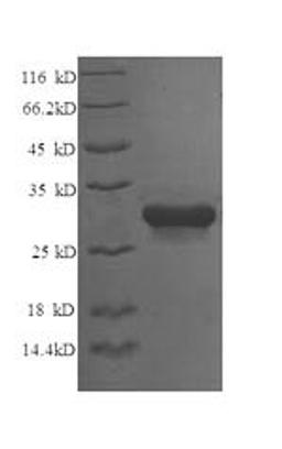 (Tris-Glycine gel) Discontinuous SDS-PAGE (reduced) with 5% enrichment gel and 15% separation gel.
